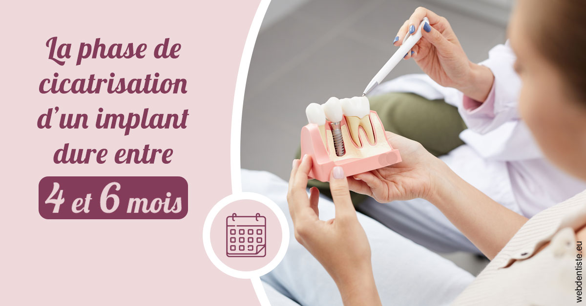 https://dr-aoun-naji.chirurgiens-dentistes.fr/Cicatrisation implant 2