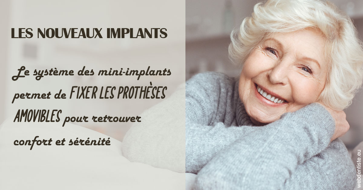 https://dr-aoun-naji.chirurgiens-dentistes.fr/Les nouveaux implants 1