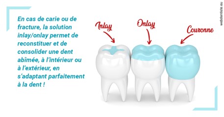 https://dr-aoun-naji.chirurgiens-dentistes.fr/L'INLAY ou l'ONLAY