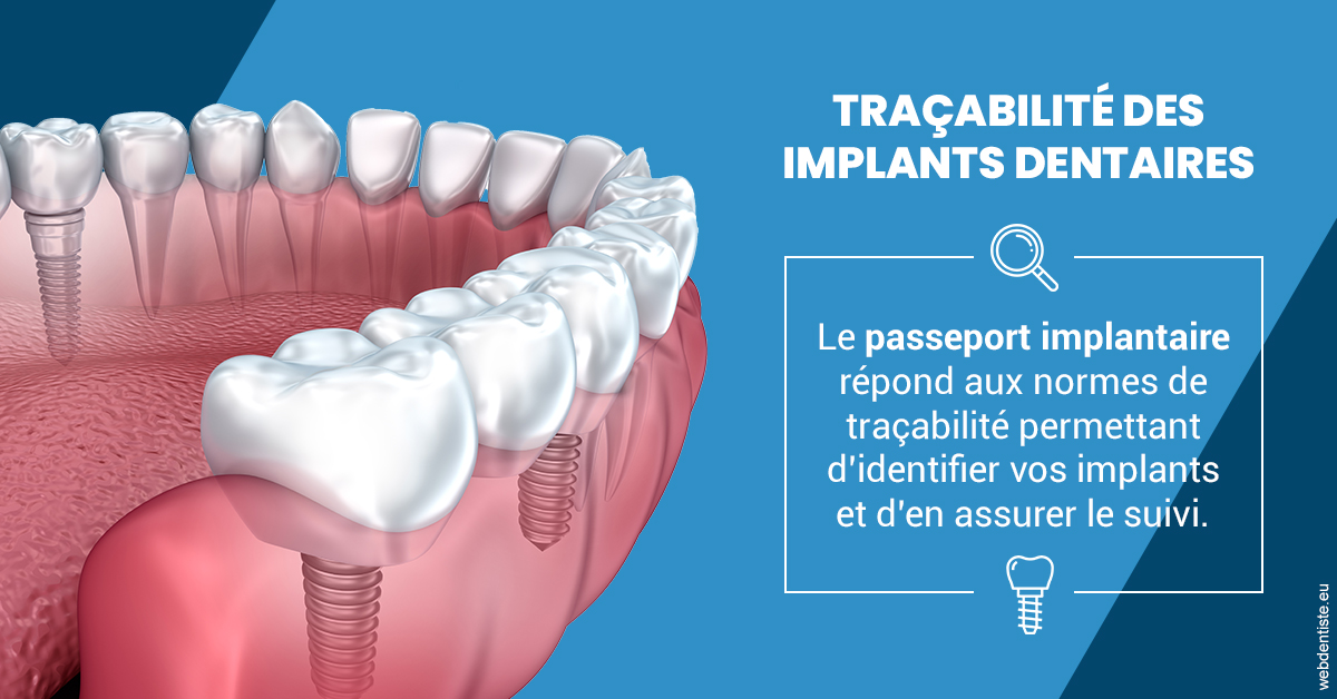 https://dr-aoun-naji.chirurgiens-dentistes.fr/T2 2023 - Traçabilité des implants 1