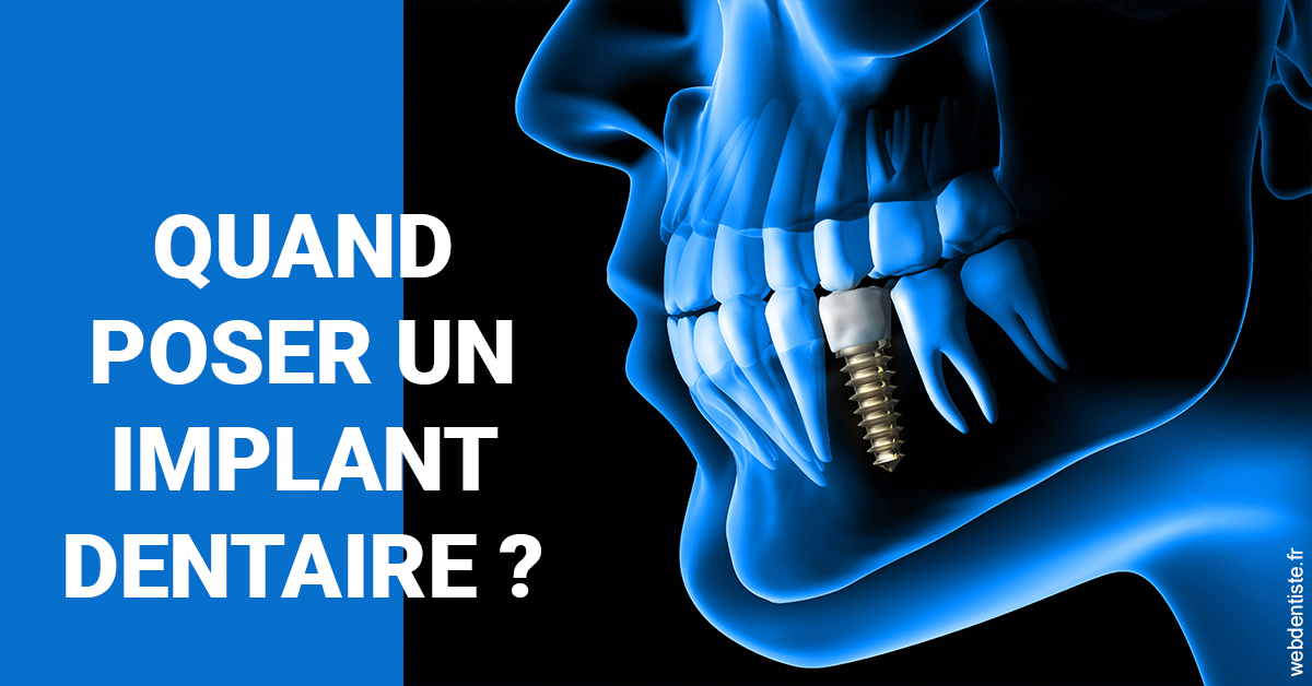 https://dr-aoun-naji.chirurgiens-dentistes.fr/Les implants 1