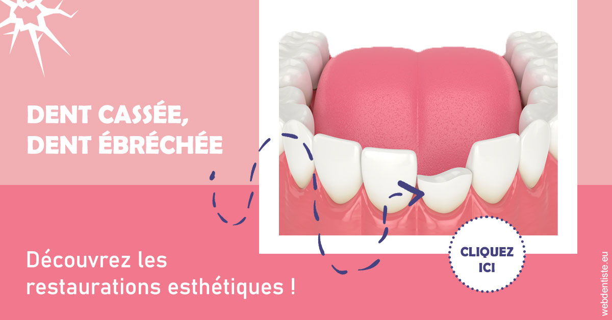 https://dr-aoun-naji.chirurgiens-dentistes.fr/Dent cassée ébréchée 1