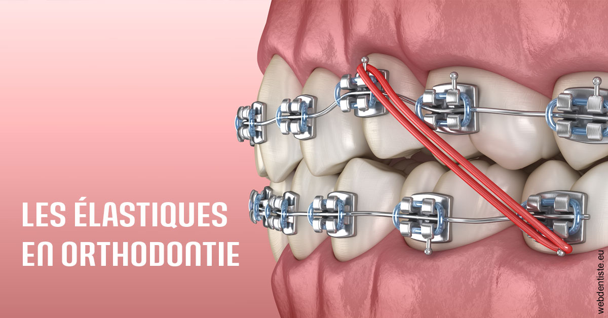 https://dr-aoun-naji.chirurgiens-dentistes.fr/Elastiques orthodontie 2
