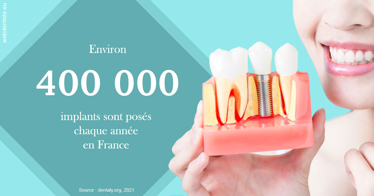 https://dr-aoun-naji.chirurgiens-dentistes.fr/Pose d'implants en France 2